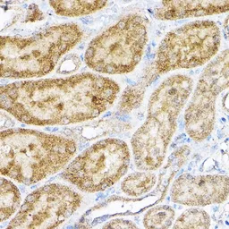 Anti-RPL4 antibody used in IHC (Paraffin sections) (IHC-P). GTX66468