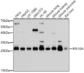 Anti-RPL10A antibody used in Western Blot (WB). GTX66471