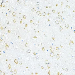 Anti-RPL10A antibody used in IHC (Paraffin sections) (IHC-P). GTX66471