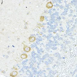Anti-RPL10A antibody used in IHC (Paraffin sections) (IHC-P). GTX66471