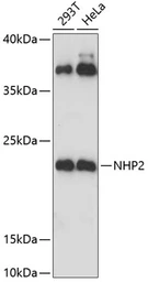 Anti-NHP2 antibody used in Western Blot (WB). GTX66475