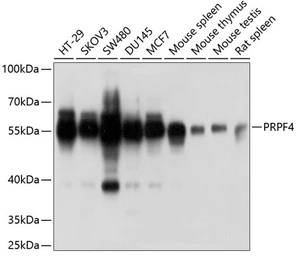 Anti-PRPF4 antibody used in Western Blot (WB). GTX66476