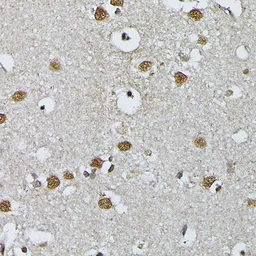 Anti-PRPF4 antibody used in IHC (Paraffin sections) (IHC-P). GTX66476