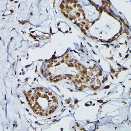 Anti-PRPF4 antibody used in IHC (Paraffin sections) (IHC-P). GTX66476