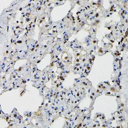 Anti-PRPF4 antibody used in IHC (Paraffin sections) (IHC-P). GTX66476