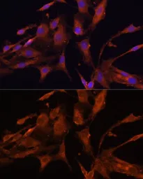 Anti-RECK antibody used in Immunocytochemistry/ Immunofluorescence (ICC/IF). GTX66481