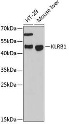 Anti-CD161 antibody used in Western Blot (WB). GTX66487