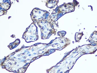Anti-GluT1 antibody used in IHC (Paraffin sections) (IHC-P). GTX66489