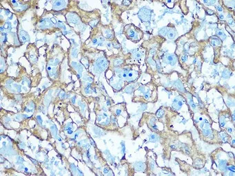 Anti-GluT1 antibody used in IHC (Paraffin sections) (IHC-P). GTX66489