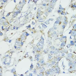 Anti-SOD3 antibody used in IHC (Paraffin sections) (IHC-P). GTX66490