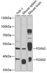 Anti-FOXN2 antibody used in Western Blot (WB). GTX66492