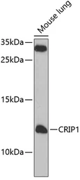 Anti-CRIP1 antibody used in Western Blot (WB). GTX66498