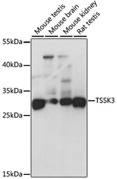 Anti-STK22C antibody used in Western Blot (WB). GTX66499