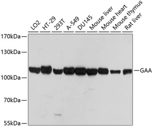 Anti-LYAG antibody used in Western Blot (WB). GTX66501