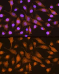 Anti-SKP2 antibody used in Immunocytochemistry/ Immunofluorescence (ICC/IF). GTX66503