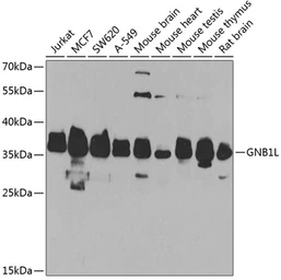 Anti-GNB1L antibody used in Western Blot (WB). GTX66505