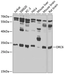 Anti-ORC6 antibody used in Western Blot (WB). GTX66507