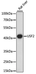Anti-USF2 antibody used in Western Blot (WB). GTX66512
