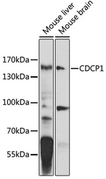 Anti-CDCP1 antibody used in Western Blot (WB). GTX66513