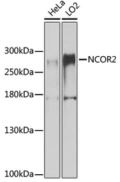 Anti-SMRT antibody used in Western Blot (WB). GTX66517