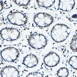 Anti-SMRT antibody used in IHC (Paraffin sections) (IHC-P). GTX66517