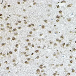 Anti-SMRT antibody used in IHC (Paraffin sections) (IHC-P). GTX66517