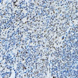 Anti-SMRT antibody used in IHC (Paraffin sections) (IHC-P). GTX66517