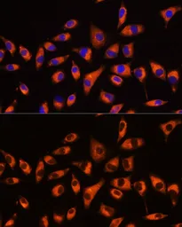 Anti-GNB2 antibody used in Immunocytochemistry/ Immunofluorescence (ICC/IF). GTX66519
