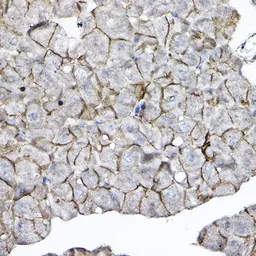 Anti-GNB2 antibody used in IHC (Paraffin sections) (IHC-P). GTX66519