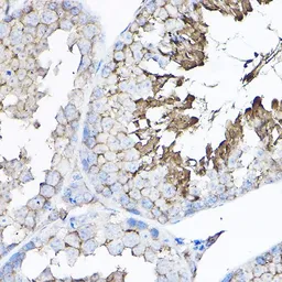 Anti-GNB2 antibody used in IHC (Paraffin sections) (IHC-P). GTX66519