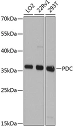 Anti-Phosducin / PDC antibody used in Western Blot (WB). GTX66520