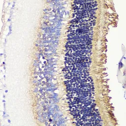 Anti-Phosducin / PDC antibody used in IHC (Paraffin sections) (IHC-P). GTX66520