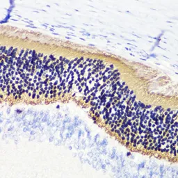 Anti-Phosducin / PDC antibody used in IHC (Paraffin sections) (IHC-P). GTX66520