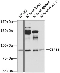 Anti-CCDC41 antibody used in Western Blot (WB). GTX66525