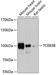 Anti-ELOA2 antibody used in Western Blot (WB). GTX66526