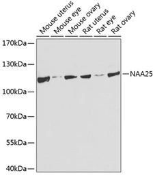 Anti-NAP1 antibody used in Western Blot (WB). GTX66529