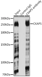 Anti-CKAP5 antibody used in Immunoprecipitation (IP). GTX66531