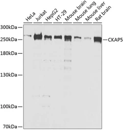 Anti-CKAP5 antibody used in Western Blot (WB). GTX66531