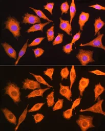 Anti-CKAP5 antibody used in Immunocytochemistry/ Immunofluorescence (ICC/IF). GTX66531