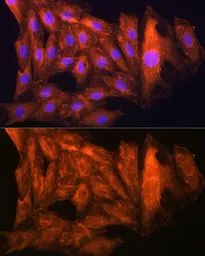 Anti-CKAP5 antibody used in Immunocytochemistry/ Immunofluorescence (ICC/IF). GTX66531