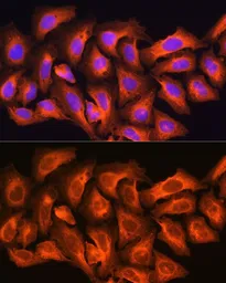 Anti-CKAP5 antibody used in Immunocytochemistry/ Immunofluorescence (ICC/IF). GTX66531