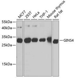 Anti-SLD5 antibody used in Western Blot (WB). GTX66532