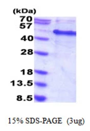 Human MAK16 protein, His tag. GTX66535-pro
