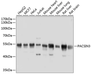 Anti-PACSIN3 antibody used in Western Blot (WB). GTX66537