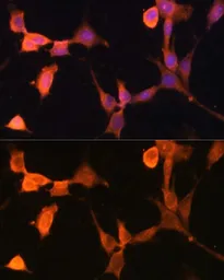 Anti-CacyBP antibody used in Immunocytochemistry/ Immunofluorescence (ICC/IF). GTX66541