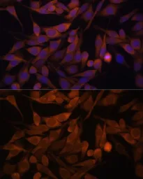 Anti-CacyBP antibody used in Immunocytochemistry/ Immunofluorescence (ICC/IF). GTX66541