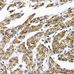 Anti-SCFD1 antibody used in IHC (Paraffin sections) (IHC-P). GTX66543