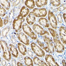 Anti-SCFD1 antibody used in IHC (Paraffin sections) (IHC-P). GTX66543