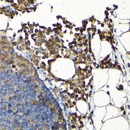 Anti-SCFD1 antibody used in IHC (Paraffin sections) (IHC-P). GTX66543