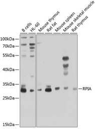 Anti-RPIA antibody used in Western Blot (WB). GTX66545